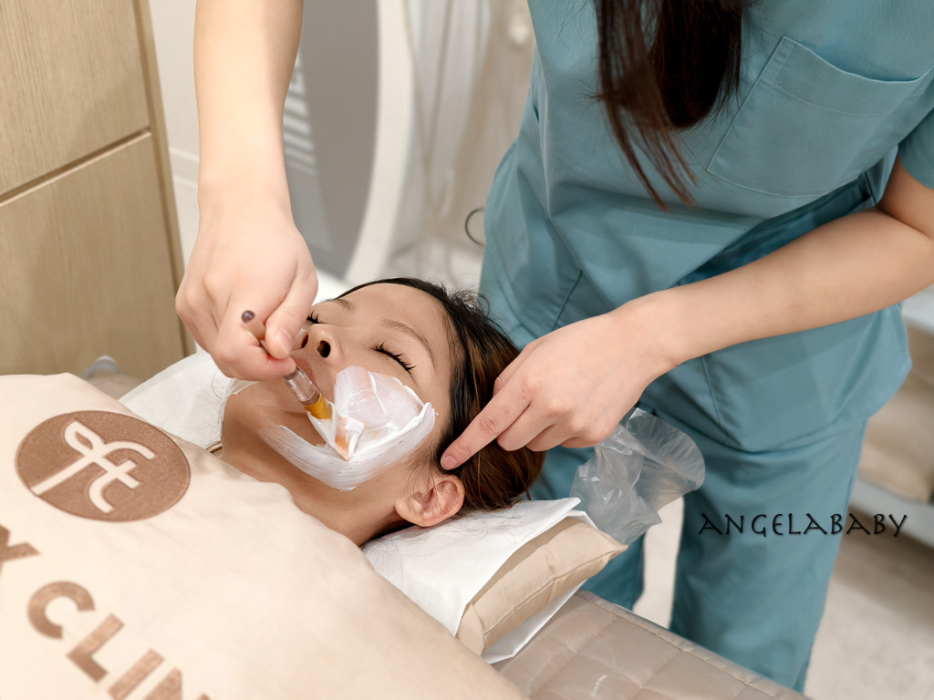 釜山醫美推薦『FillsToks CLINIC』필스톡스의원開業13年、可中文溝通的釜山醫美皮膚管理、可退稅 @梅格(Angelababy)享樂日記