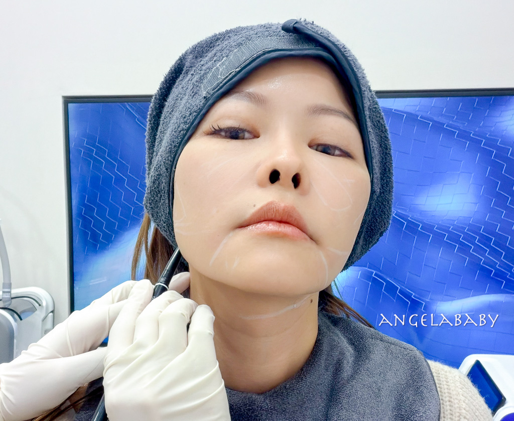 首爾皮膚管理｜江南醫美診所推薦『麗貝瑞皮膚科 (江南店)』Re:berry Clinic  線上預約 @梅格(Angelababy)享樂日記