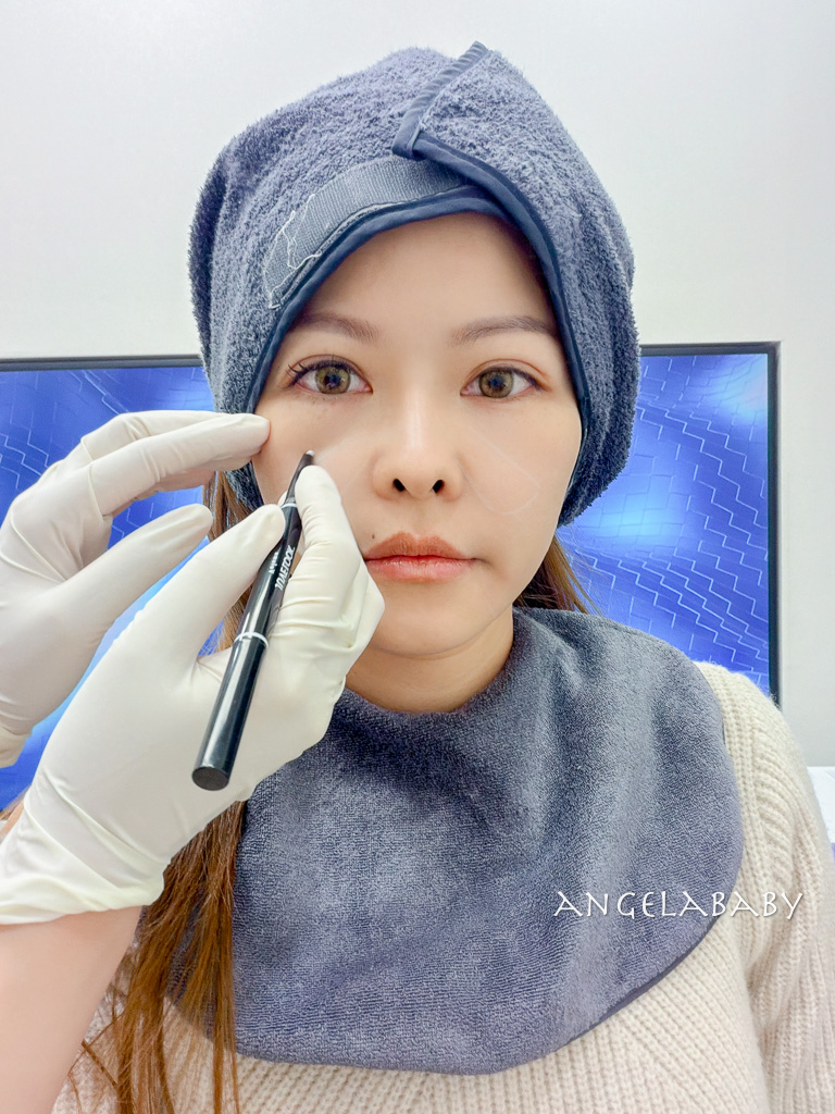 首爾皮膚管理｜江南醫美診所推薦『麗貝瑞皮膚科 (江南店)』Re:berry Clinic  線上預約 @梅格(Angelababy)享樂日記