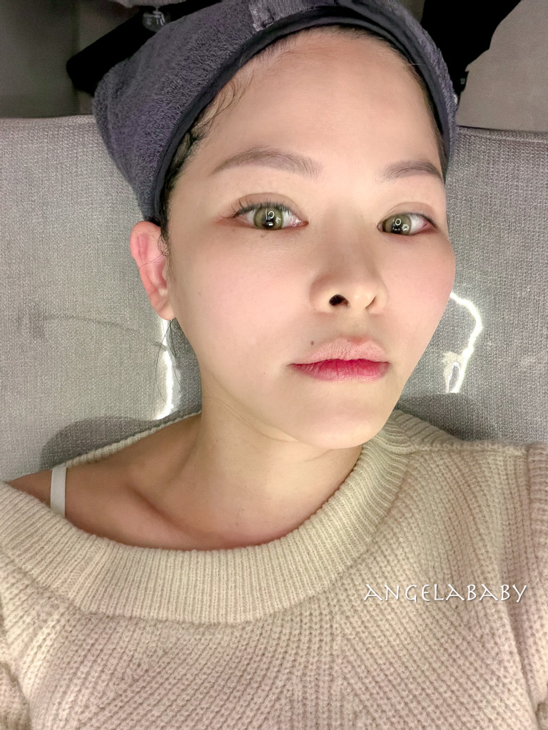 首爾皮膚管理｜江南醫美診所推薦『麗貝瑞皮膚科 (江南店)』Re:berry Clinic  線上預約 @梅格(Angelababy)享樂日記